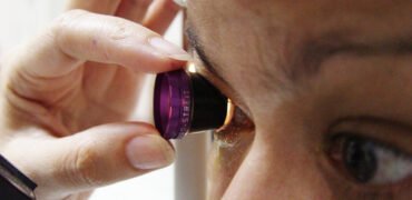 Exames IOMC 2 Gonioscopia IOMC