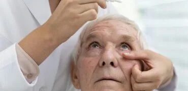 Cirurgia glaucoma scaled e1701795453752